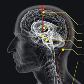 epilepsi