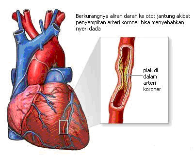 Penjelasan Seputar Penyakit Jantung